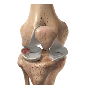 الغضروف الهلالي