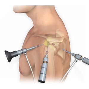 منظار الكتف